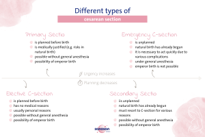 infographics c-section