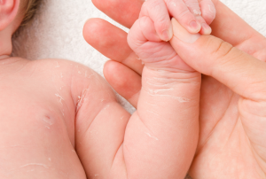 baby mit schuppung und trockener haut am koerper